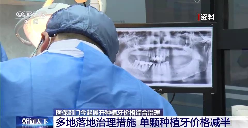 种牙降价了!多地已调整(图2) 51.png