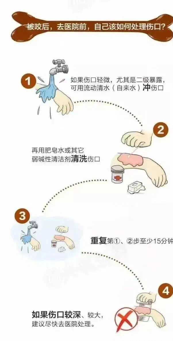 男子被爱犬舔了一口,多器官衰竭死亡!病因不是狂犬病…(图6) 7.jpg