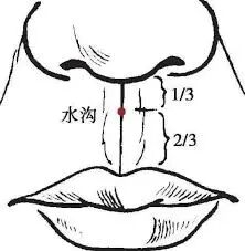 当代岐黄医理科学解读:紧急纠正对“人中穴”的误读(图2) 11.jpg